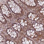 RNF19B Antibody in Immunohistochemistry (Paraffin) (IHC (P))