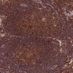 RNF19B Antibody in Immunohistochemistry (Paraffin) (IHC (P))
