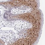ZNF142 Antibody in Immunohistochemistry (Paraffin) (IHC (P))