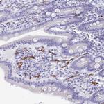 KRIT1 Antibody in Immunohistochemistry (Paraffin) (IHC (P))