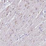 KRIT1 Polyclonal Antibody