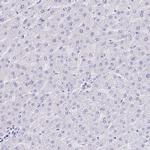 KRIT1 Antibody in Immunohistochemistry (Paraffin) (IHC (P))