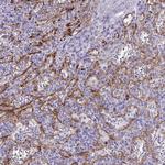KRIT1 Antibody in Immunohistochemistry (Paraffin) (IHC (P))
