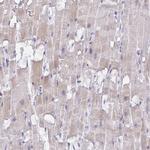 FTSJ2 Polyclonal Antibody