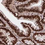 CNKSR3 Polyclonal Antibody