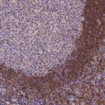 FGD2 Polyclonal Antibody