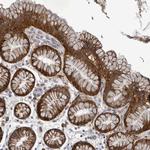 ATP13A1 Antibody in Immunohistochemistry (Paraffin) (IHC (P))