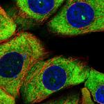 RPS11 Polyclonal Antibody