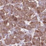 RPS11 Antibody in Immunohistochemistry (IHC)