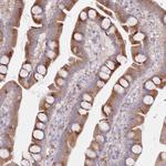 SPATS1 Polyclonal Antibody