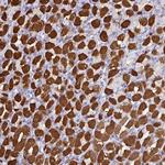 PEX10 Polyclonal Antibody