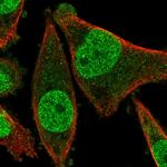 FRAT2 Polyclonal Antibody