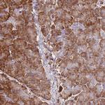 FRAT2 Antibody in Immunohistochemistry (Paraffin) (IHC (P))