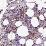 HTR3E Antibody in Immunohistochemistry (Paraffin) (IHC (P))