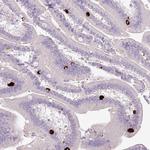 HTR3E Antibody in Immunohistochemistry (Paraffin) (IHC (P))
