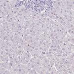HTR3E Antibody in Immunohistochemistry (Paraffin) (IHC (P))