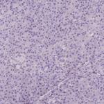 HTR3E Polyclonal Antibody