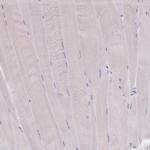 HTR3E Antibody in Immunohistochemistry (Paraffin) (IHC (P))
