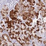 ZNF627 Polyclonal Antibody