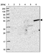 ZNF627 Antibody in Western Blot (WB)
