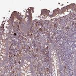 NHSL2 Polyclonal Antibody