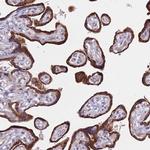 FAM227B Polyclonal Antibody