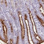FBXO48 Antibody in Immunohistochemistry (Paraffin) (IHC (P))