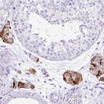 STOX2 Polyclonal Antibody