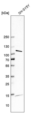 STOX2 Antibody in Western Blot (WB)