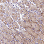 SSUH2 Antibody in Immunohistochemistry (Paraffin) (IHC (P))