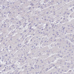 SSUH2 Antibody in Immunohistochemistry (Paraffin) (IHC (P))