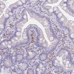SSUH2 Antibody in Immunohistochemistry (IHC)
