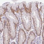 SRrp35 Polyclonal Antibody