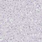 SUPT16H Antibody in Immunohistochemistry (Paraffin) (IHC (P))