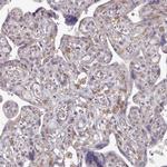 COL8A2 Antibody in Immunohistochemistry (IHC)