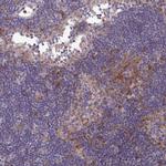 COL8A2 Antibody in Immunohistochemistry (IHC)