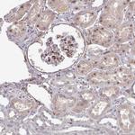 COL8A2 Antibody in Immunohistochemistry (IHC)