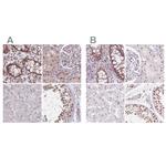 ZC3H14 Antibody in Immunohistochemistry (IHC)
