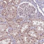 ZC3H14 Antibody in Immunohistochemistry (IHC)