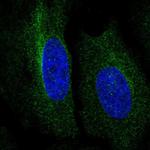 RNF167 Polyclonal Antibody