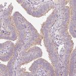 RNF167 Antibody in Immunohistochemistry (Paraffin) (IHC (P))