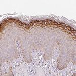 RNF167 Antibody in Immunohistochemistry (Paraffin) (IHC (P))