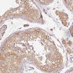 RNF167 Antibody in Immunohistochemistry (Paraffin) (IHC (P))