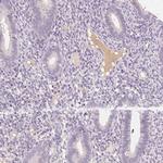 CFHR2 Antibody in Immunohistochemistry (Paraffin) (IHC (P))