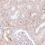 CFHR2 Antibody in Immunohistochemistry (Paraffin) (IHC (P))