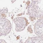 CFHR2 Antibody in Immunohistochemistry (Paraffin) (IHC (P))