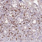 ST3GAL4 Antibody in Immunohistochemistry (Paraffin) (IHC (P))
