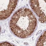 ST3GAL4 Polyclonal Antibody