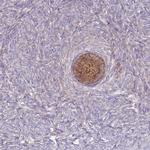 ST3GAL4 Antibody in Immunohistochemistry (IHC)