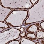 SALL1 Antibody in Immunohistochemistry (IHC)
